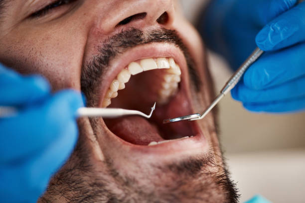 Professional Emergency Dental Service in TX